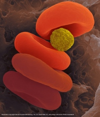 Illustration for article titled Incredible medical breakthrough allows doctors to inject oxygen into the bloodstreams of people who can't breathe